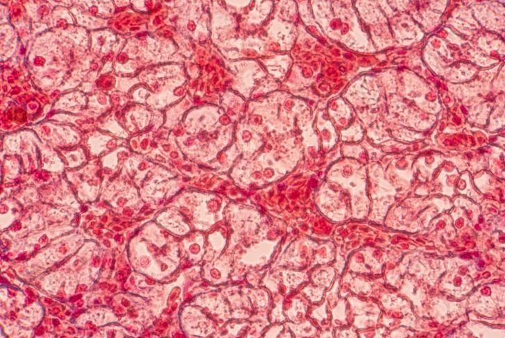 Cosa significa cellule epiteliali squamose? 7