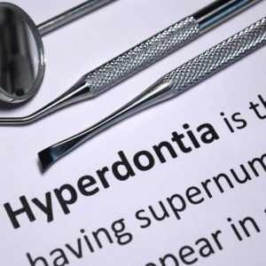 Hyperdontia: Are Extra Teeth a Problem? Hyperdontia: Are Extra Teeth a Problem?