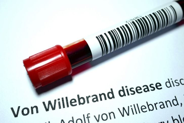Tutto sulla malattia di von Willebrand 5