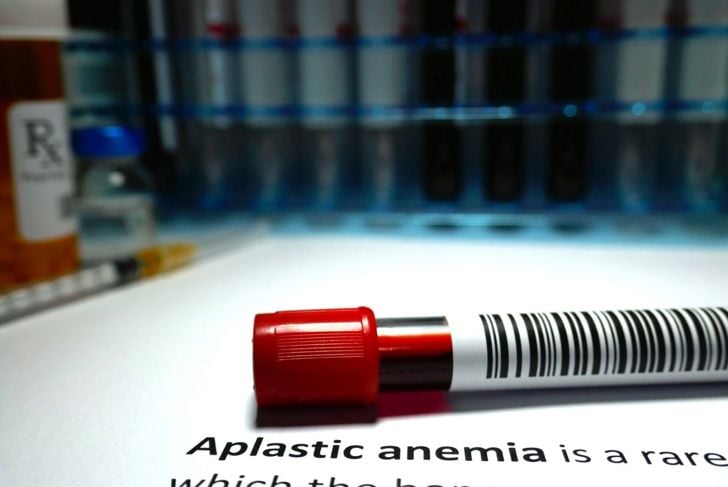 Che cos'è l'anemia aplastica? 1