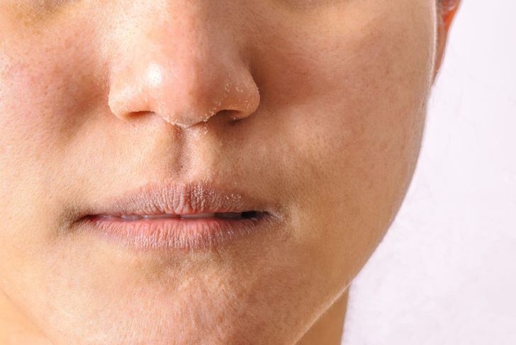 10 Sintomi e trattamenti principali della sindrome della bocca secca 3
