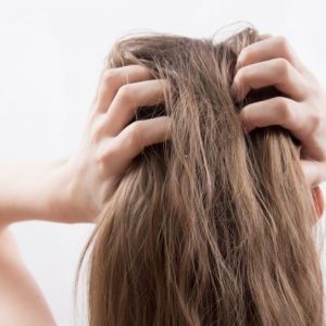 10 benefici dell’amamelide per la salute 10 benefici dell’amamelide per la salute