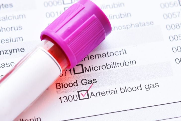 Domande frequenti sugli esami dei gas nel sangue arterioso 3