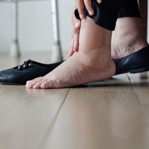 Identificazione e trattamento delle ulcere cutanee Identificazione e trattamento delle ulcere cutanee