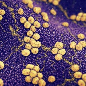 Cosa c’è da sapere sui carbuncoli Cosa c’è da sapere sui carbuncoli