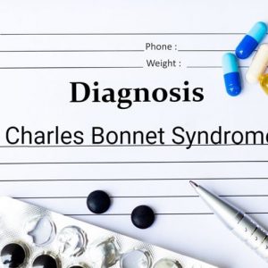 Comprendere la sindrome di Charles Bonnet Comprendere la sindrome di Charles Bonnet