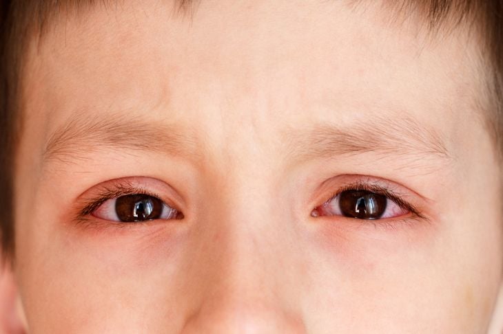 Infezioni oculari comuni e come trattarle 1