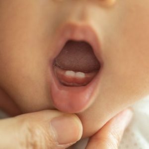 Cronologia della dentizione dal bambino all’adulto Cronologia della dentizione dal bambino all’adulto