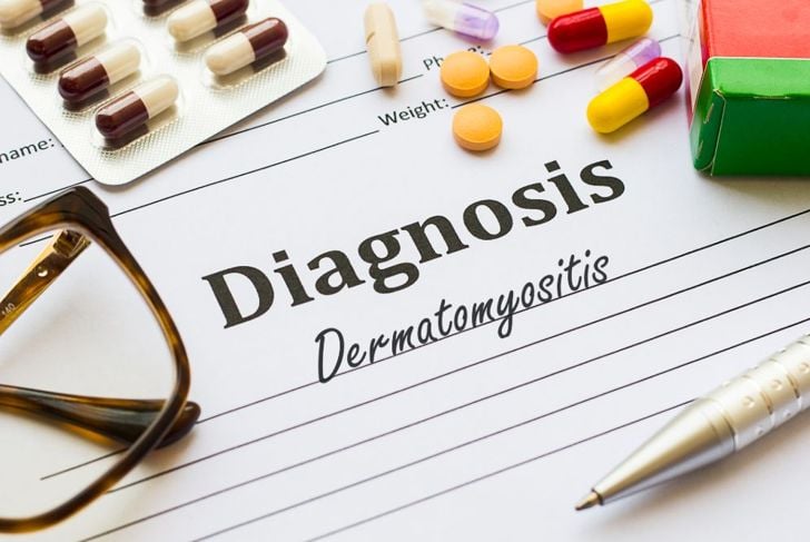 Che cos'è la dermatomiosite? 1