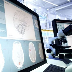 Cause e prognosi della sindrome di Locked-In Cause e prognosi della sindrome di Locked-In