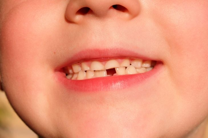 La guida dei genitori alla fatina dei denti 11