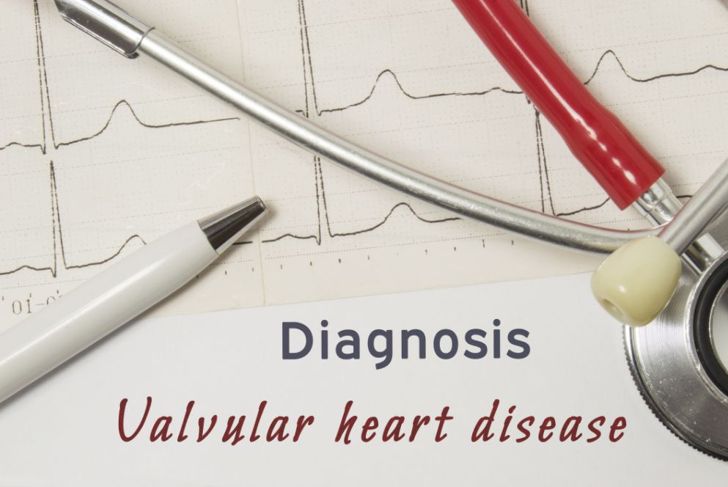 Quanto ne sapete di queste comuni patologie cardiache? 11