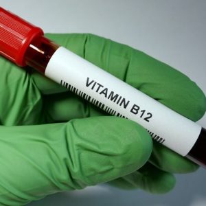 10 cose da sapere sulla B12 10 cose da sapere sulla B12