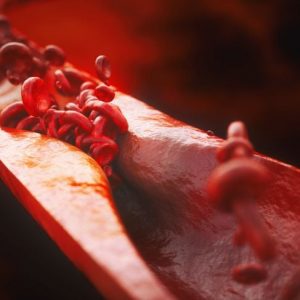 I motivi principali per consumare il riso nero I motivi principali per consumare il riso nero