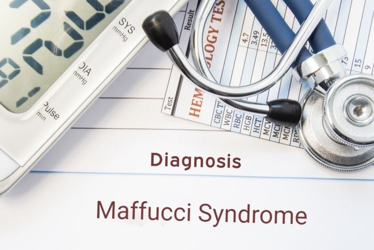 Sindrome di Maffucci: Cause, sintomi e trattamento 1