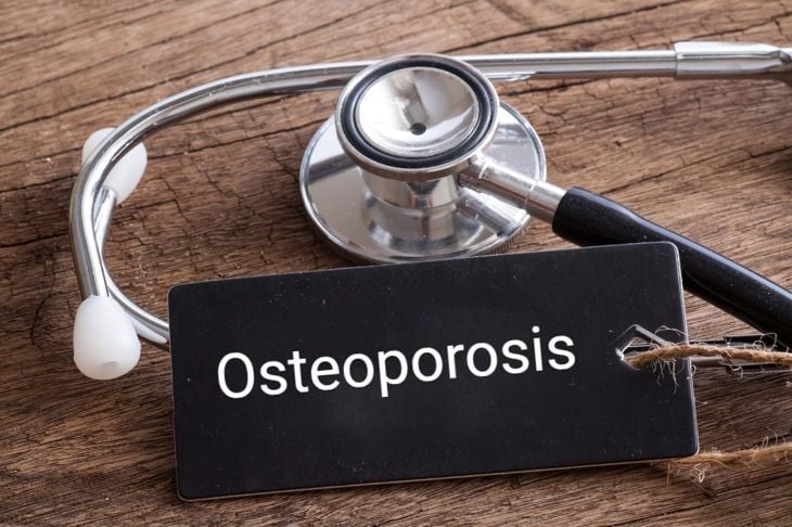 Domande frequenti sull'osteopenia 19