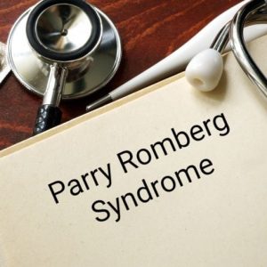 La sindrome di Parry Romberg, un raro disturbo della pelle La sindrome di Parry Romberg, un raro disturbo della pelle