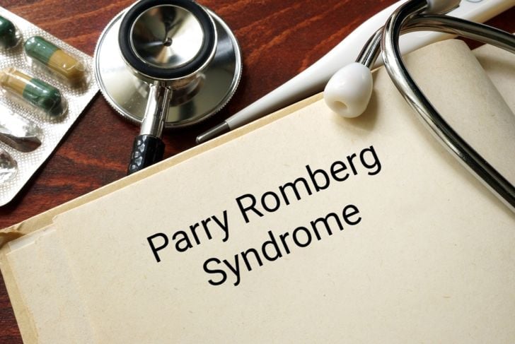 La sindrome di Parry Romberg, un raro disturbo della pelle 1