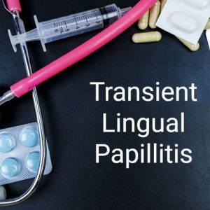 Protuberanze sulla lingua: Papillite linguale transitoria