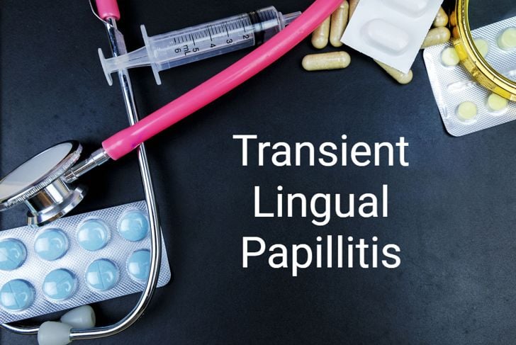 Protuberanze sulla lingua: Papillite linguale transitoria 1