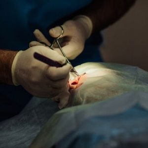 Chirurgia di Mohs: Un ritorno al passato per il trattamento del cancro della pelle Chirurgia di Mohs: Un ritorno al passato per il trattamento del cancro della pelle
