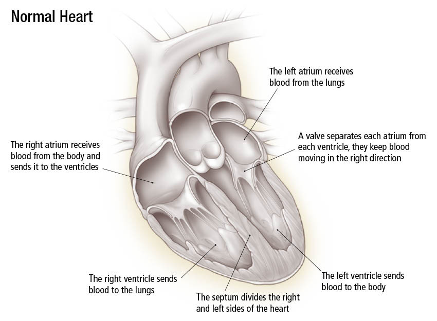 Cardiomiopatia Cardiomiopatia