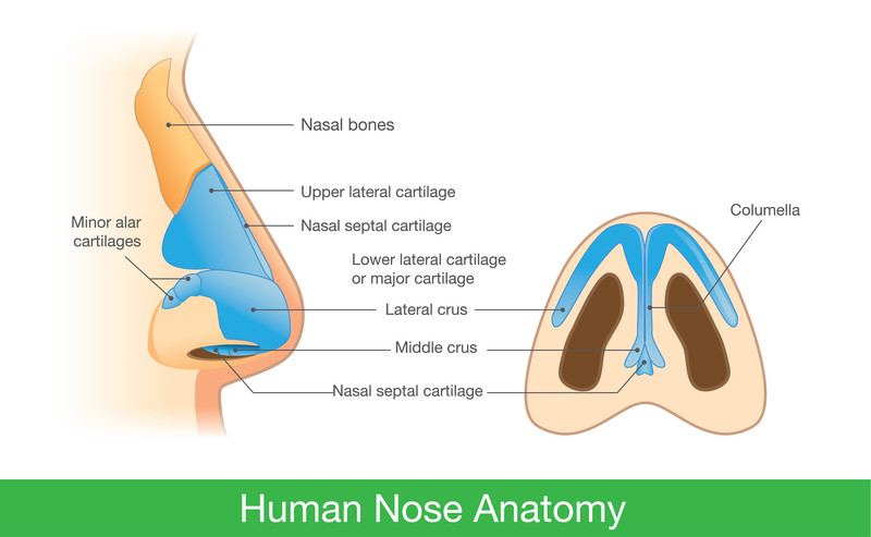 Emorragia nasale (epistassi) 1