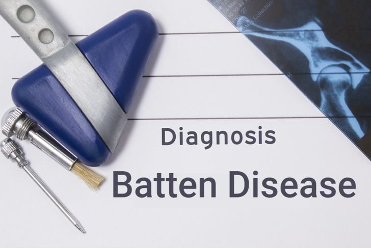 Prognosi della malattia di Batten e speranza di una cura 5