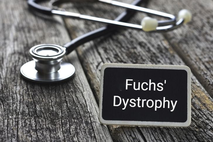 Che cos'è la distrofia di Fuchs? 19