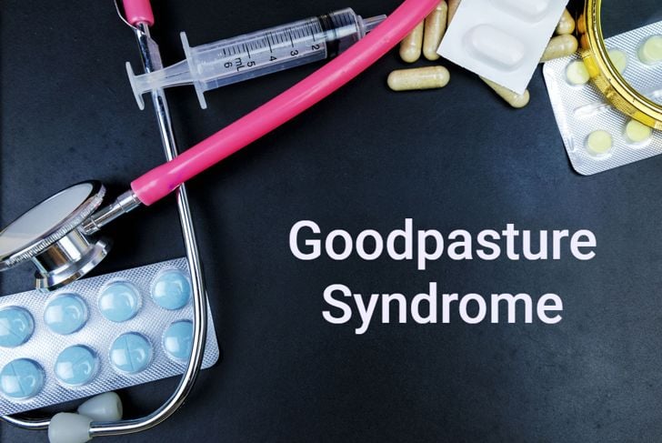 Sindrome di Goodpasture: una malattia rara e acuta 5