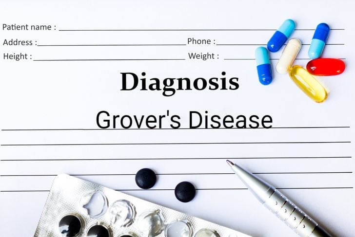 Malattia di Grover: Un raro disturbo della pelle 1