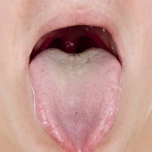 7 cose che la lingua dice sulla vostra salute