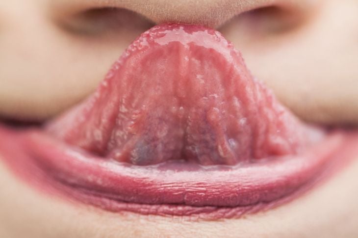 7 cose che la lingua dice sulla vostra salute 9