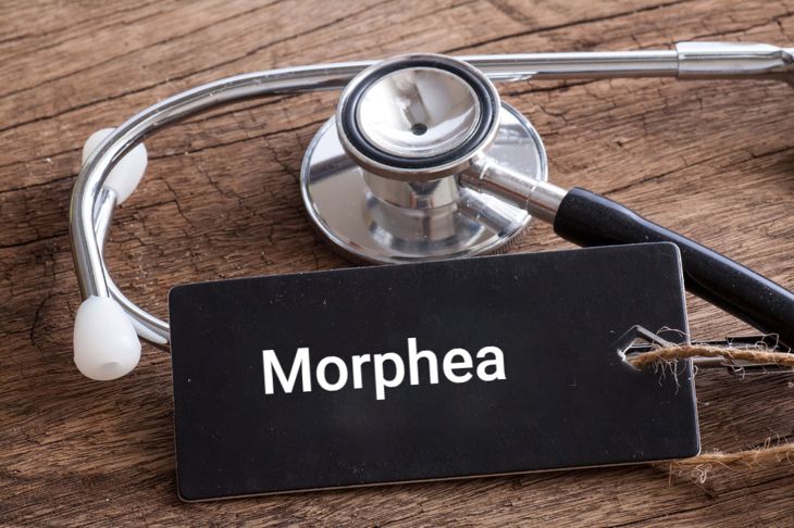 Segni, cause e trattamenti della morfea 19