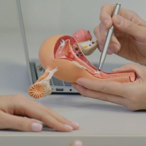 Cosa devono sapere le pazienti sulle isterectomie Cosa devono sapere le pazienti sulle isterectomie