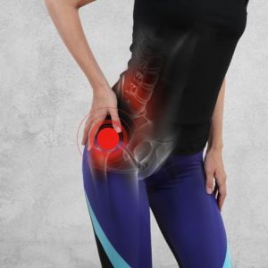 10 Sintomi e trattamenti per la borsite dell’anca