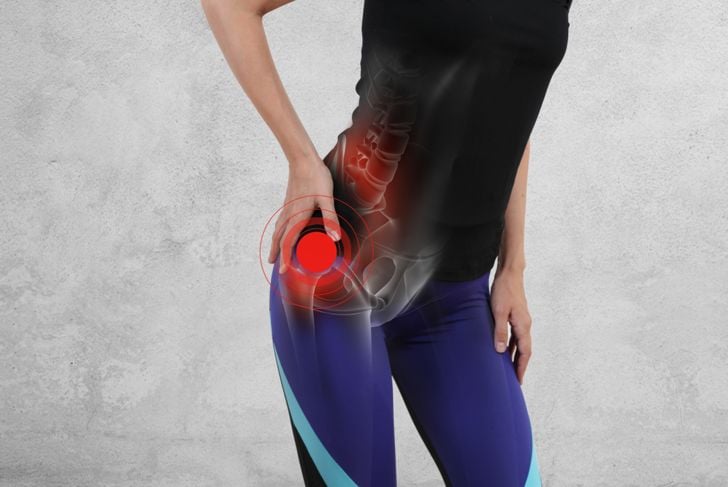 10 Sintomi e trattamenti per la borsite dell'anca 1