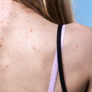 Le malattie della pelle più comuni Le malattie della pelle più comuni