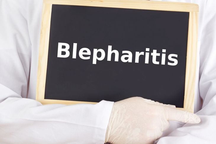 Cause e sintomi della blefarite 3