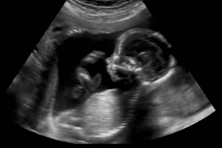 Miti comuni sulla gravidanza, veri e falsi 13