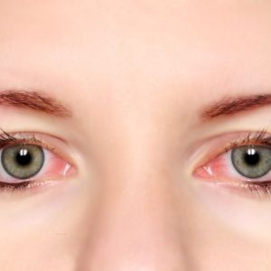 10 sintomi dell’occhio rosa