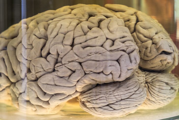 25 fatti sorprendenti sul vostro cervello 21