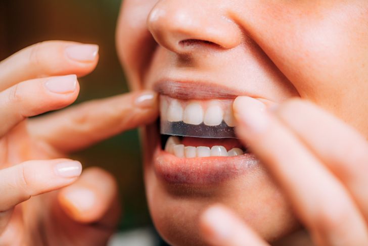 Come si sviluppa la sensibilità dentale? 9