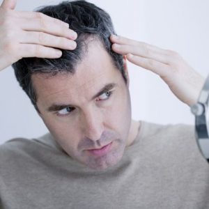 Le 9 principali cause di perdita di capelli negli uomini