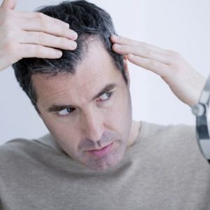 Le principali cause di perdita di capelli negli uomini