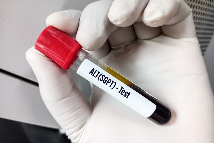 Capire gli esami del sangue ALT e i loro risultati 1