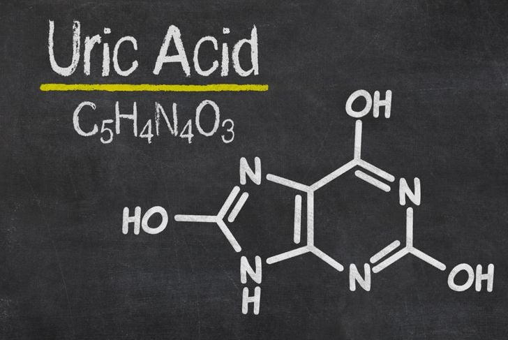 Conoscete il vostro livello di acido urico? 1