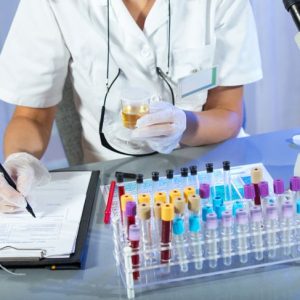 Test di screening comuni per le malattie