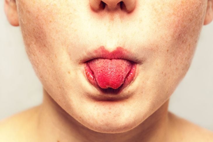 7 cose che la lingua dice sulla vostra salute 3