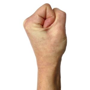 10 Sintomi e trattamenti della malattia di Buerger 10 Sintomi e trattamenti della malattia di Buerger